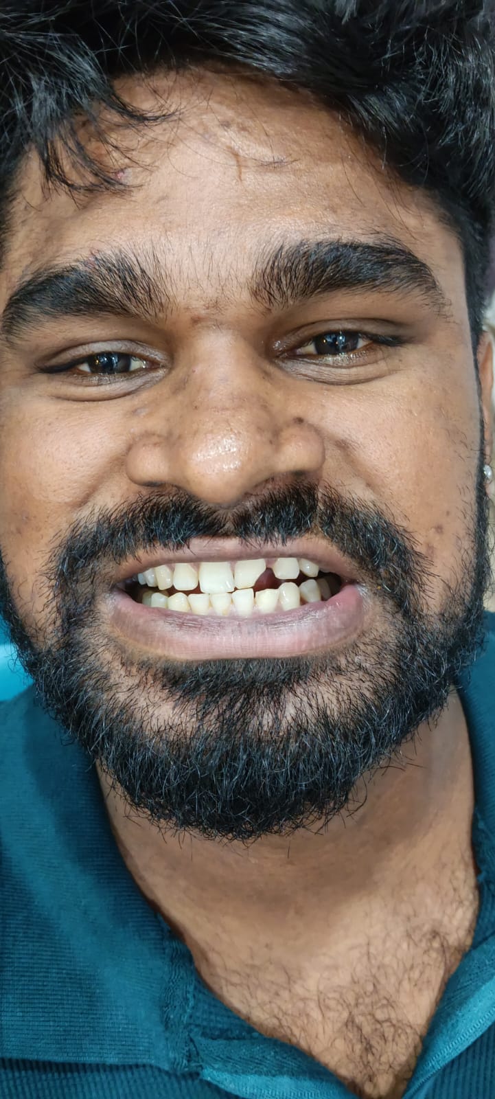 Happy Patient